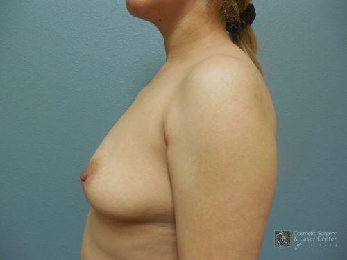 photo_gallery_before997case_3.jpg