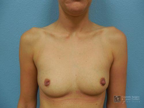 photo_gallery_before998case_1.jpg
