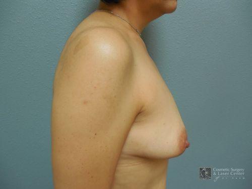 photo_gallery_before999case_2.jpg