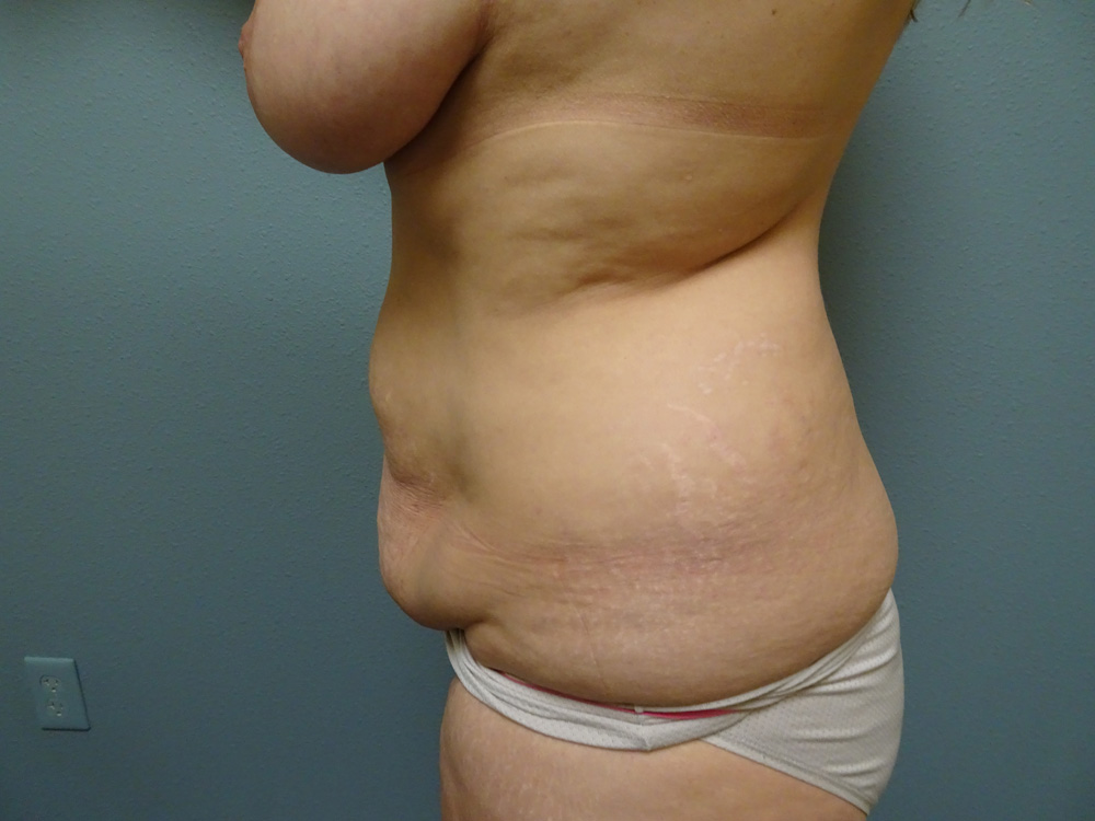 before-left