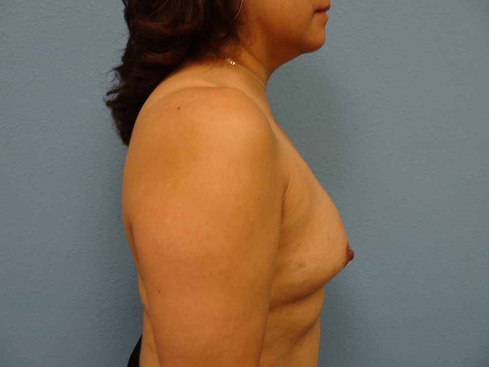 DSC01975